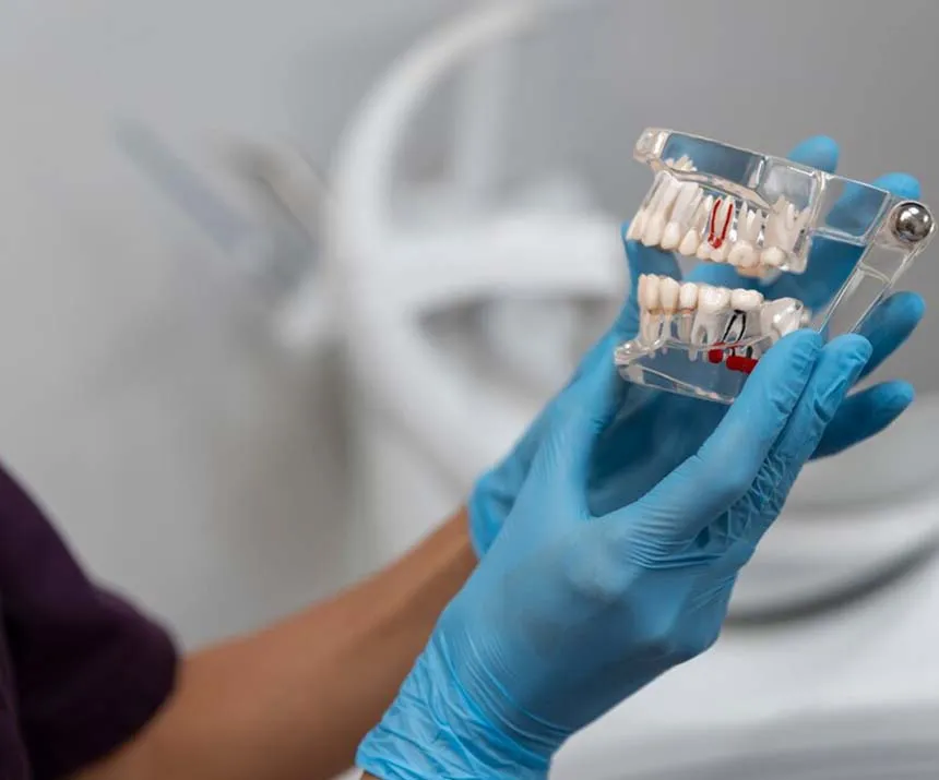 روش های قالب گیری ایمپلنت دندانی روش های قالب گیری ایمپلنت دندانی